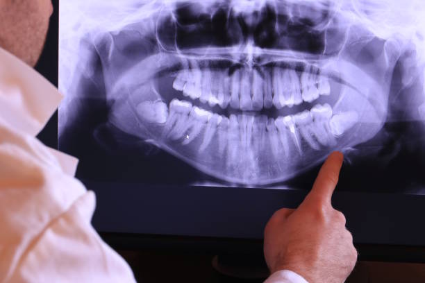 Best Emergency Gum Treatment in Atkins, IA
